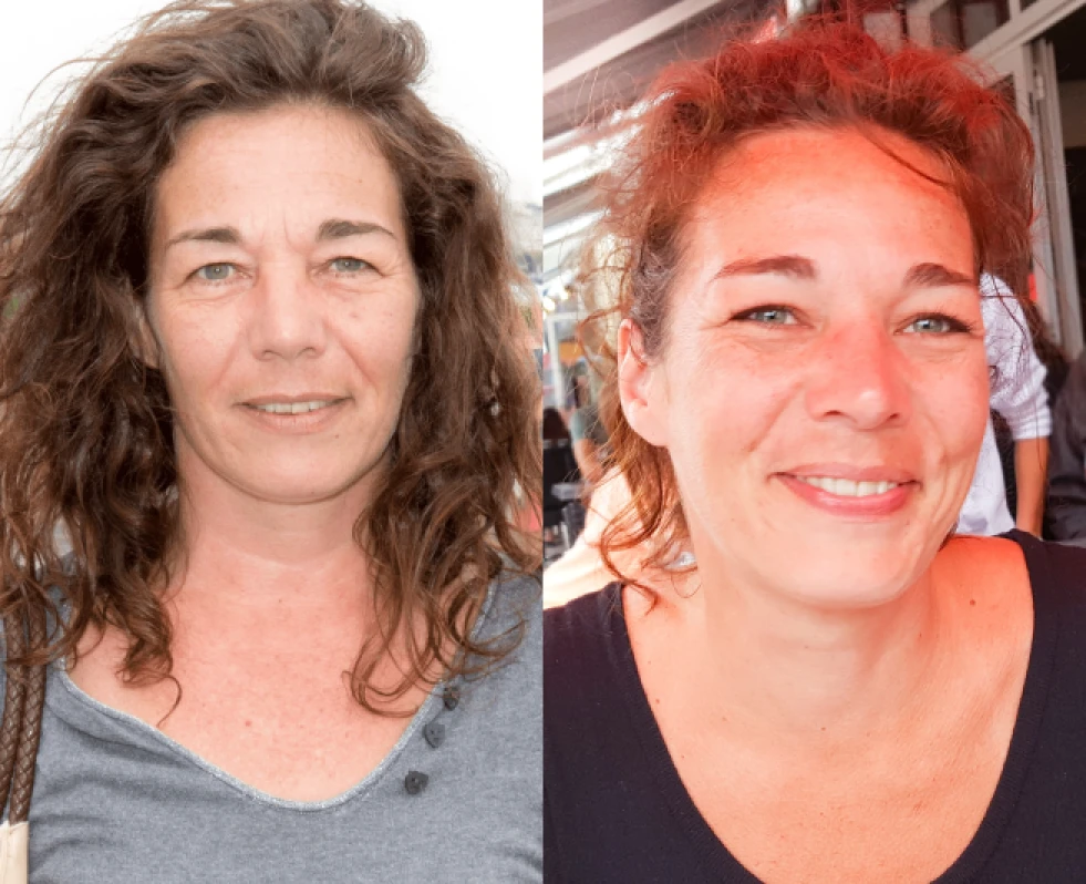 before-after